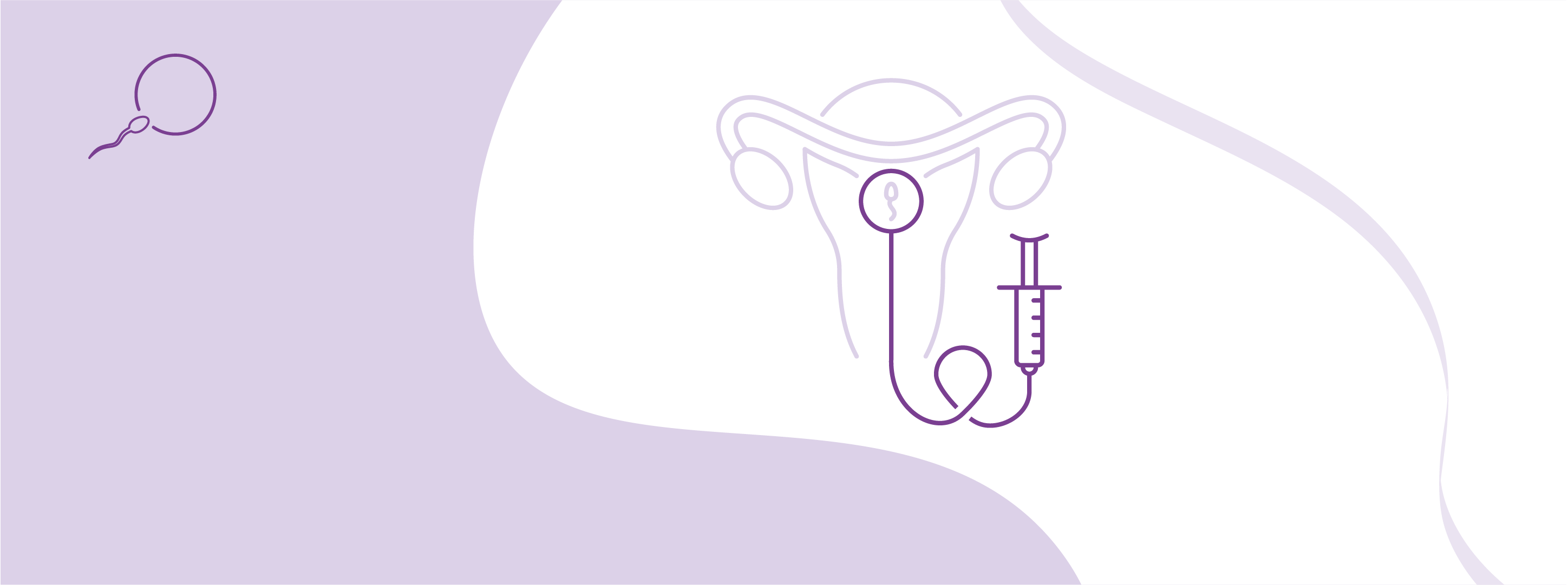 Intrauterine insemination program