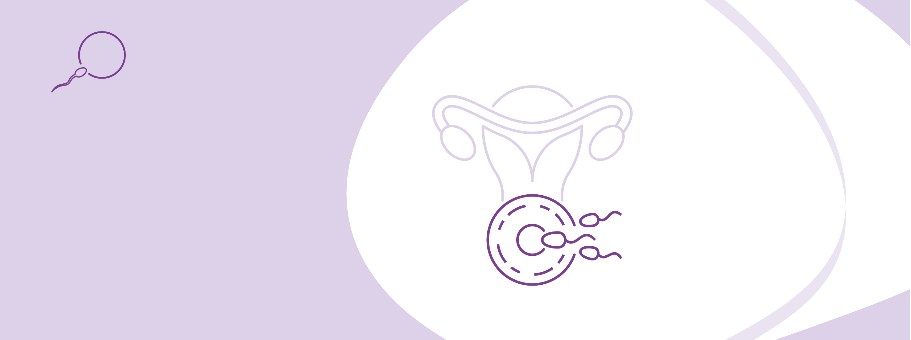 IVF program with drug stimulation and embryo transfer